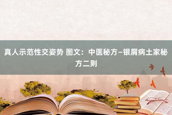 真人示范性交姿势 图文：中医秘方—银屑病土家秘方二则