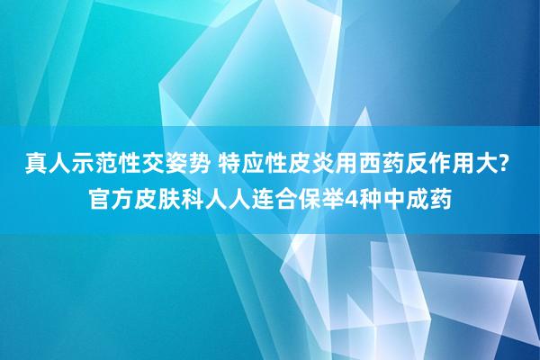 真人示范性交姿势 特应性皮炎用西药反作用大? 官方皮肤科人人连合保举4种中成药